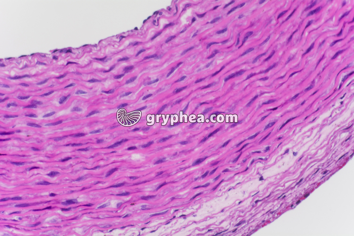 Paroi artérielle x100 - gryphea.org